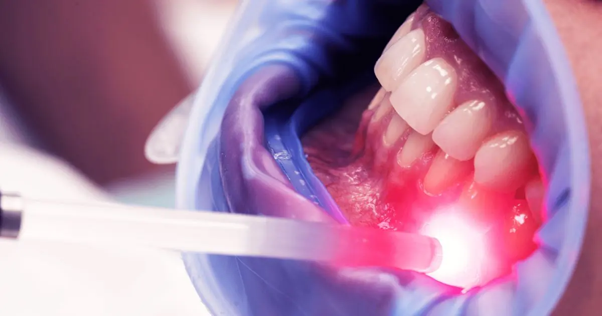 Laserterapia de baixa intensidade realizado pela Dra. Letícia Aguiar