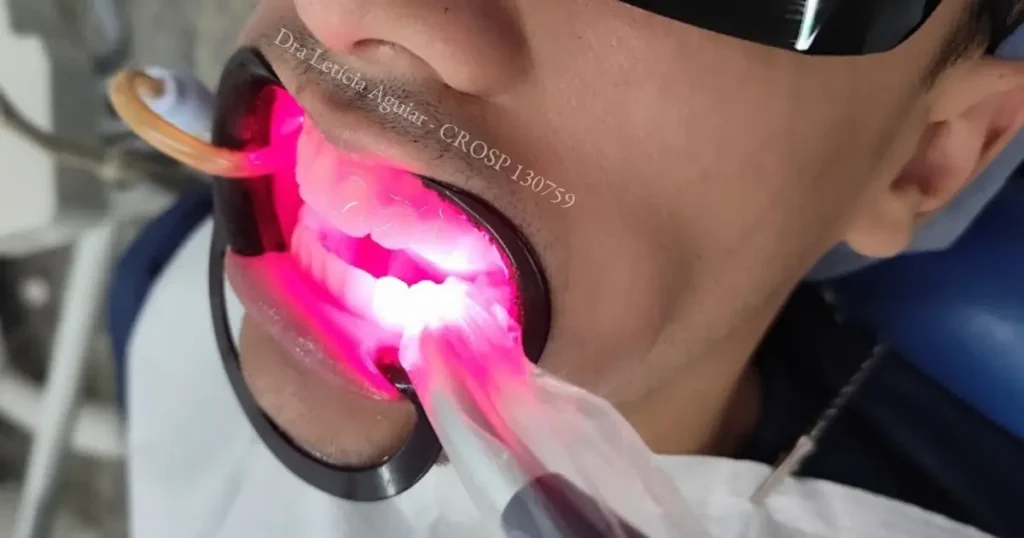 Tratamento para sensibilidade dentária com laserterapia